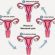 Siklus Menstruasi